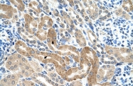 ARP45827_T100 - CAF-1 subunit B
