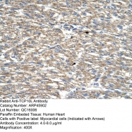 ARP45902_T100 - TCP10L