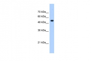 ARP46034_P050 - IFI60 / IFIT3