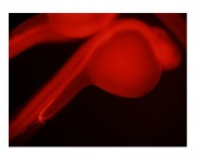 ARP46110_T100 - NOLC1