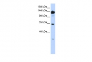 ARP46151_P050 - VARS (Valyl-tRNA synthetase)