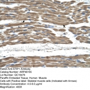 ARP46165_T100 - STIP1