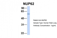 ARP46179_P050 - NUP62
