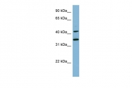 ARP46185_P050 - B-cell linker protein / BLNK