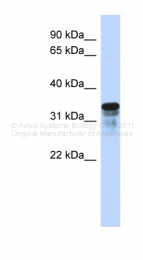 ARP46236_P050 - FAM82B