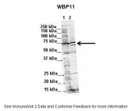 ARP46241_P050 - WBP11