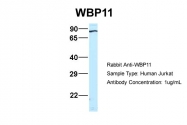 ARP46241_P050 - WBP11