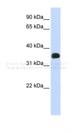 ARP46331_P050 - C2orf47