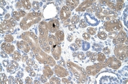 ARP46385_T100 - ST3GAL5
