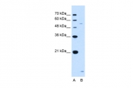 ARP46385_T100 - ST3GAL5