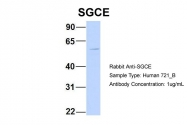 ARP46387_P050 - Epsilon-sarcoglycan / SGCE
