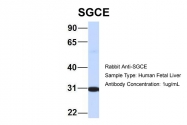 ARP46387_P050 - Epsilon-sarcoglycan / SGCE