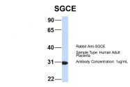 ARP46387_P050 - Epsilon-sarcoglycan / SGCE