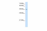 ARP46418_T100 - TMPRSS11D