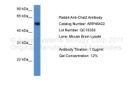 ARP46422_P050 - CHST2