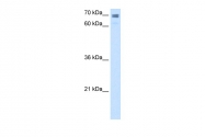 ARP46436_T100 - Calmegin