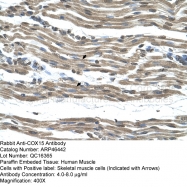 ARP46442_T100 - COX15