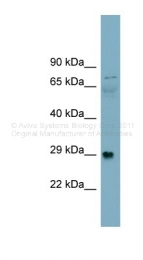 ARP46445_P050 - Dystroglycan