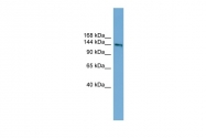 ARP46583_P050 - Netrin receptor DCC