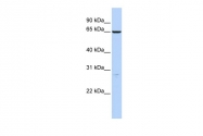ARP46595_P050 - Hyaluronic acid synthase 3 / HAS3