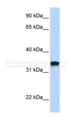 ARP46596_P050 - Hyaluronic acid synthase 3 / HAS3