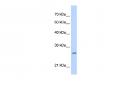 ARP46601_P050 - MLF2