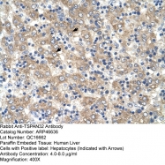 ARP46636_T100 - Tetraspanin-32 (TSPAN32)