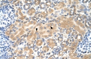 ARP46640_P050 - Tetraspanin-5 (TSPAN5)