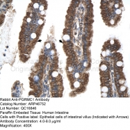 ARP46752_P050 - PGRMC1