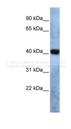 ARP46814_P050 - TMEM115 / PL6