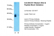 ARP46851_P050 - BACE1