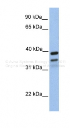 ARP46862_P050 - FKBP8 / FKBP38