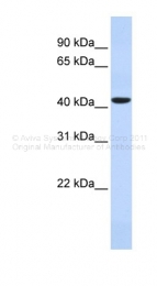 ARP46869_P050 - TIMD1 / HAVCR1