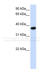 ARP46894_P050 - ICMT / PCCMT