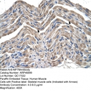 ARP46899_T100 - Neuroplastin / SDFR1
