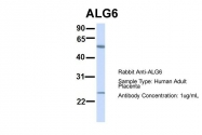 ARP46927_P050 - ALG6