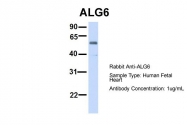 ARP46927_P050 - ALG6