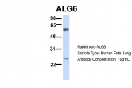 ARP46927_P050 - ALG6
