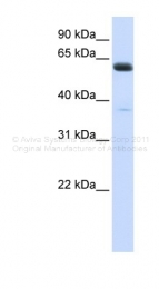 ARP46928_P050 - ALG6
