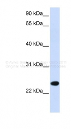 ARP46949_P050 - PILRB