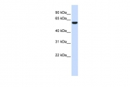 ARP46954_P050 - Neuregulin 1