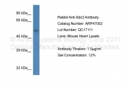 ARP47052_P050 - Syndecan-3 (SDC3)