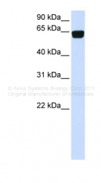 ARP47202_P050 - PIGT