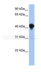 ARP47251_P050 - PTPLAD1 / BIND1