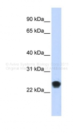 ARP47279_P050 - FKBP11 / FKBP19