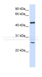 ARP47363_P050 - TMEM127