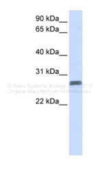 ARP47388_P050 - TMEM51