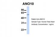ARP47389_P050 - ANO10 / TMEM16K