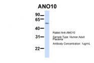 ARP47389_P050 - ANO10 / TMEM16K