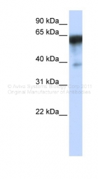 ARP47408_P050 - KIRREL1